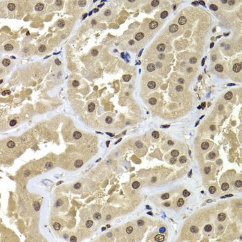 Immunohistochemistry - ACTL6B Polyclonal Antibody (144-07108)