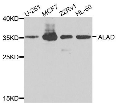 Western blot - ALAD Polyclonal Antibody (144-08398)