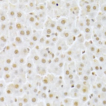 Immunohistochemistry - CDK4 Polyclonal Antibody (144-00366)