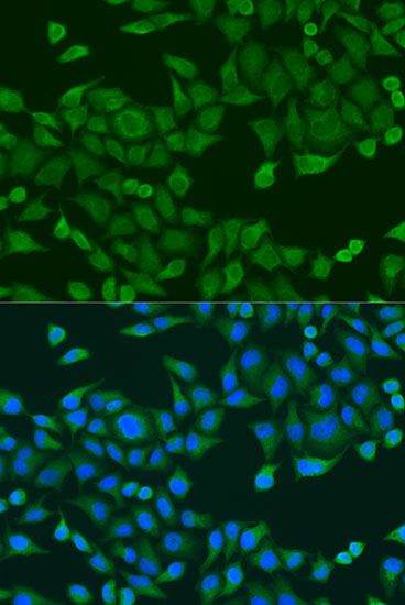 Immunofluorescence - RPS27A antibody (144-02027)