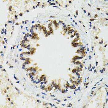 Immunohistochemistry - RUVBL2 antibody (144-12564)