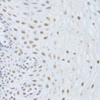 Immunohistochemistry - BAG1 Antibody (144-01104)