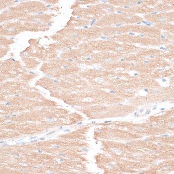 Immunohistochemistry - EGFR antibody (144-02069)