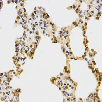 Immunohistochemistry - MonoMethyl-Histone H3-K27 antibody (144-02361)