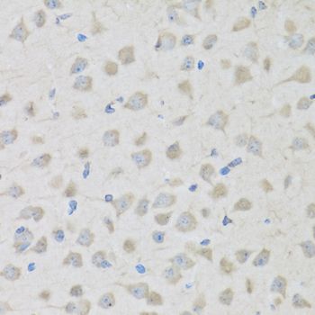 Immunohistochemistry - PENK antibody (144-06302)