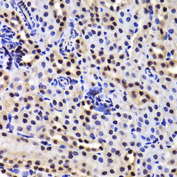 Immunohistochemistry - GABPB1 Polyclonal Antibody (144-06909)