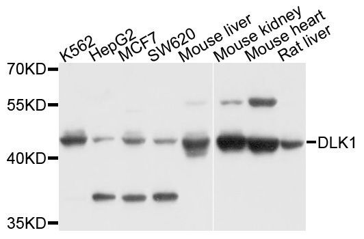 Western blot - DLK1 antibody (144-02715)