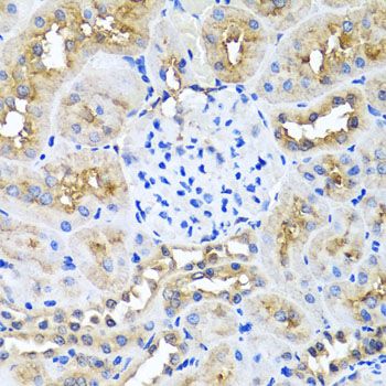 Immunohistochemistry - NIN antibody (144-08215)