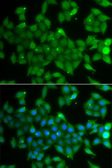 Immunofluorescence - ANXA11 Polyclonal Antibody (144-07423)