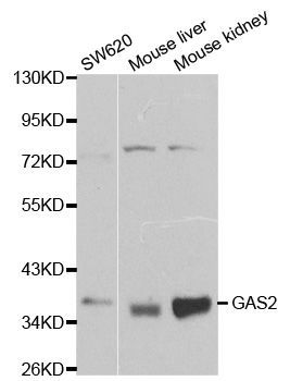 Western blot - GAS2 antibody (144-01168)