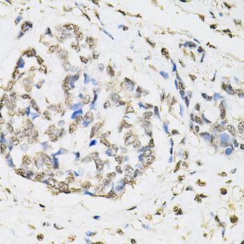 Immunohistochemistry - PSMB1 Polyclonal Antibody (144-01043)