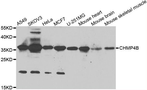 Western blot - CHMP4B antibody (144-07402)