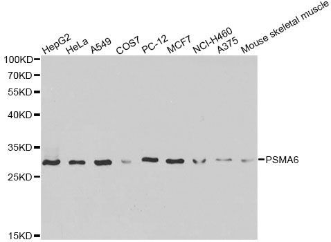 Western blot - PSMA6 Polyclonal Antibody (144-60381)