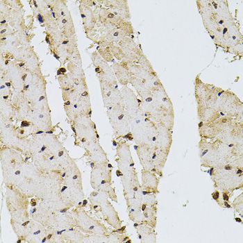 Immunohistochemistry - PPP2R5C antibody (144-05480)