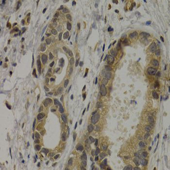 Immunohistochemistry - MAGEA1 antibody (144-05470)