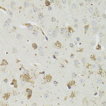 Immunohistochemistry - PTPN3 antibody (144-06400)