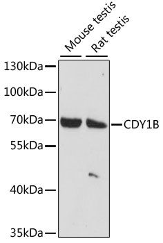 Western blot - CDY1B antibody (144-61118)