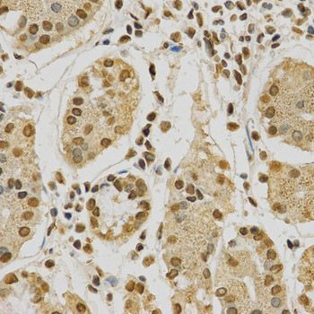 Immunohistochemistry - [KO Validated] HNRNPA2B1 Polyclonal Antibody (144-01162)