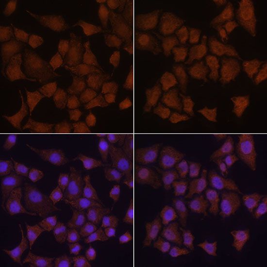 Immunohistochemistry - MAP1LC3B Polyclonal Antibody (144-07198)