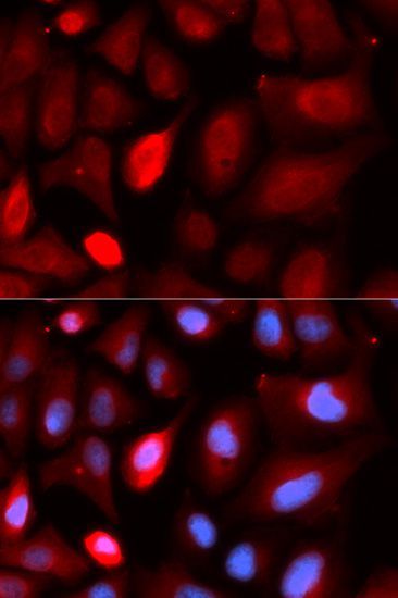Immunofluorescence - PDLIM5 Polyclonal Antibody (144-05720)