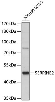 Western blot