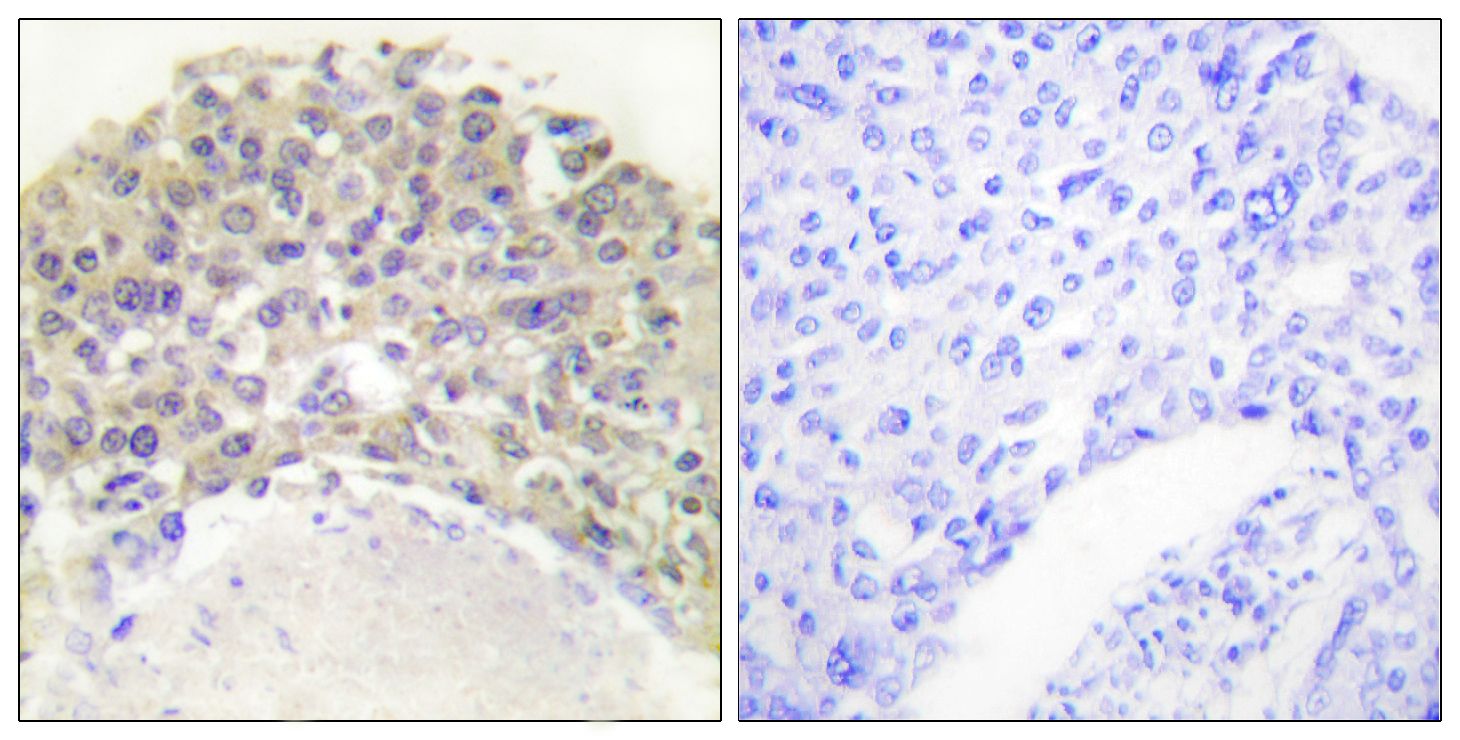 IHC