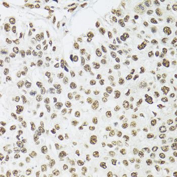 Immunohistochemistry - SFPQ Polyclonal Antibody (144-00958)