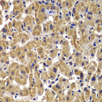 Immunohistochemistry - MMP14 antibody (144-02549)
