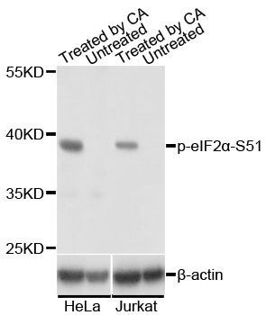 Western blot - Phospho-eIF2?-S51 pAb (144-61508)