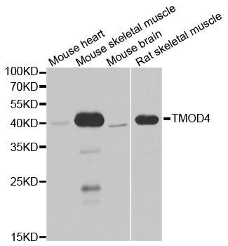 Western blot - TMOD4 antibody (144-06772)