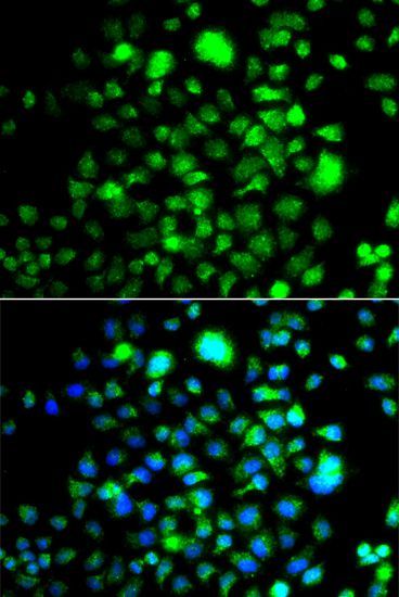 Immunofluorescence - PEX14 antibody (144-07336)