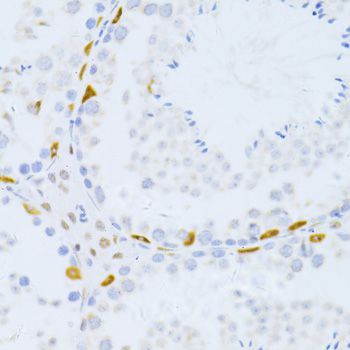 Immunohistochemistry - ZEB2 Polyclonal Antibody (144-05705)