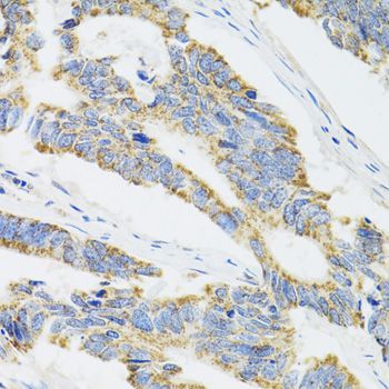 Immunohistochemistry - CYP1A1 antibody (144-02159)