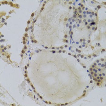 Immunohistochemistry - HDGF Antibody (144-05347)