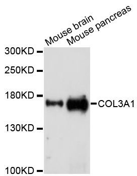 Western blot - COL3A1 antibody (144-03795)