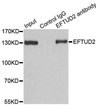 Immunoprecipitation - 3ug EFTUD2 antibody (144-07040)