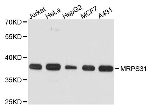 Western blot - MRPS31 antibody (144-12923)