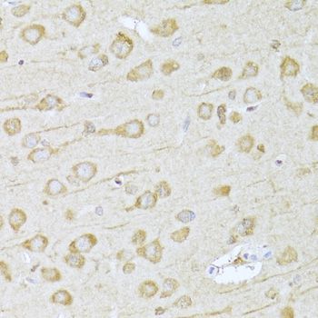 Western blot - FDPS Polyclonal Antibody (144-05744)