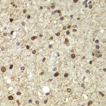 Immunohistochemistry - POU5F1 Polyclonal Antibody (144-07920)