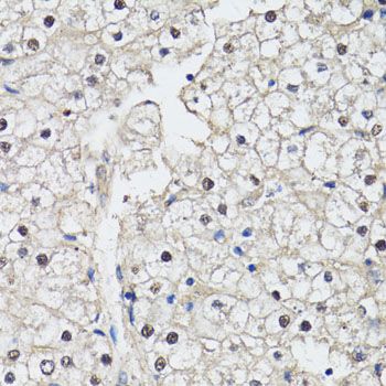 Immunohistochemistry - CDK7 antibody (144-012942)