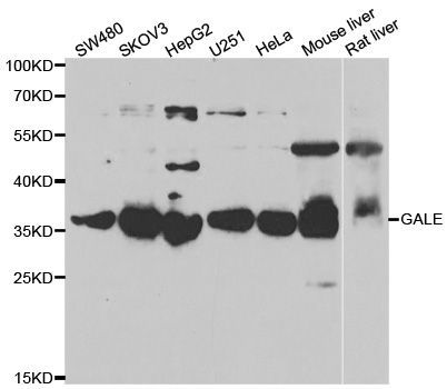 Western blot - GALE antibody (144-06595)