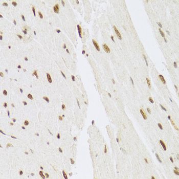 Immunohistochemistry - MAPK3 Polyclonal Antibody (144-00228)