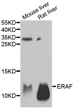 Western blot - AHSP Polyclonal Antibody (144-06465)