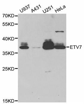 Western blot - ETV7 Polyclonal Antibody (144-06255)