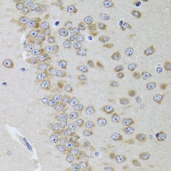 Immunohistochemistry - GRIN2A Polyclonal Antibody (144-00924)
