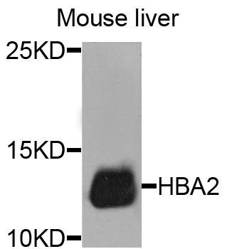 Western blot - HBA2 antibody (144-08427)