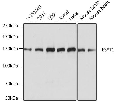 Western blot - ESYT1 antibody (144-015410)