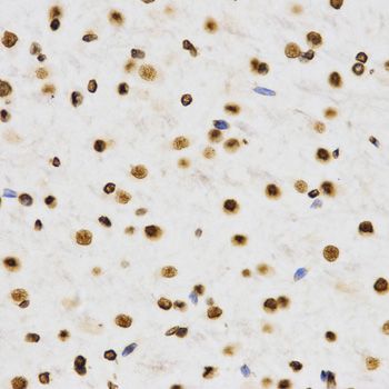Immunohistochemistry - DiMethyl-Histone H3-K9 antibody (144-02359)