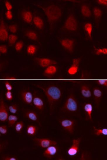 Immunofluorescence - ATP7B antibody (144-05676)
