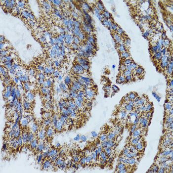 Immunohistochemistry - MRPL28 Polyclonal Antibody (144-05897)